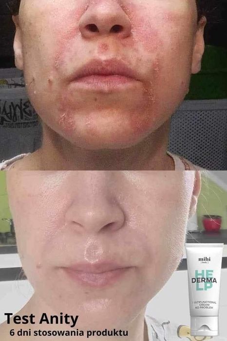 Krem Wielofunkcyjny NO PROBLEM 75ml