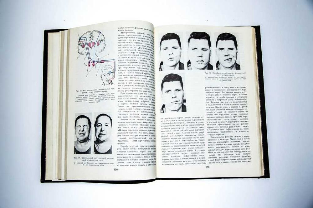 Топическая диагностика заболеваний нервной системы. А. Скоромец 1989