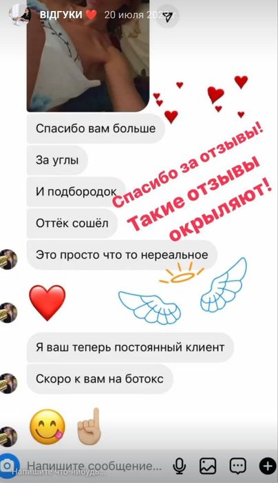 Ботокс, Губи, Біоревіталізація. АКЦІЯ