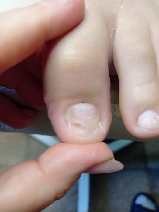 (Маникюр) наращивание, подологический  педикюр, депиляция, (Вишнево