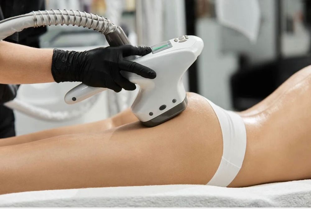 Velasmooth VelaShape Aparelho profissional de estética