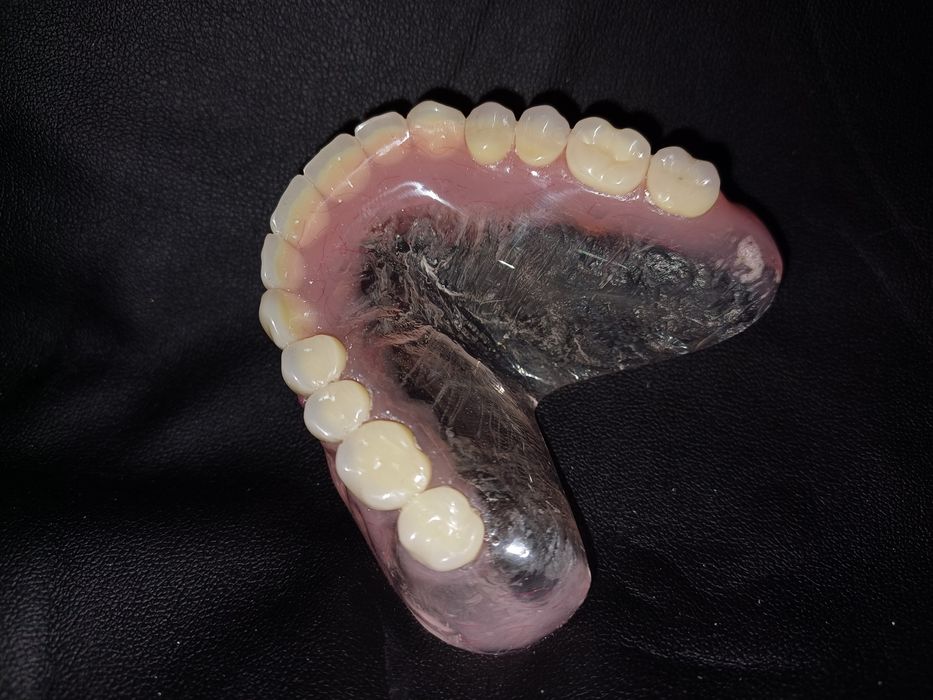 Зубний технік!Співпраця зі стоматологом