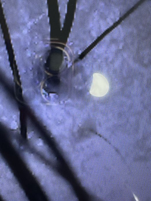 Posso te ajudar a ter seu cabelo e couro cabeludo mais saudavel