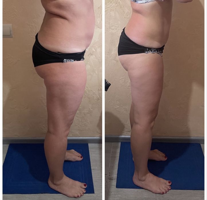 Массаж эпиляция. Только для женщин. Улица Степана Тільгы 34 А