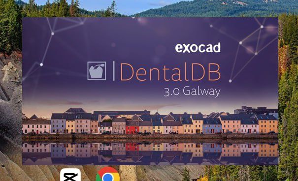 Exocad 3.0 Galway