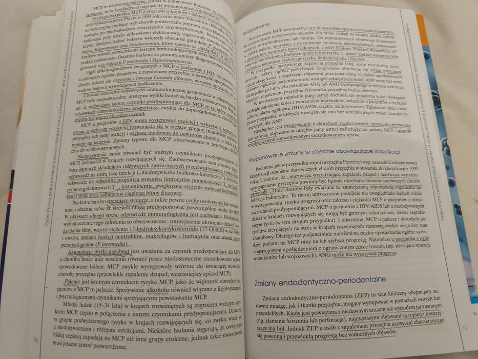 Choroby przyzębia klasyfikacja 2017