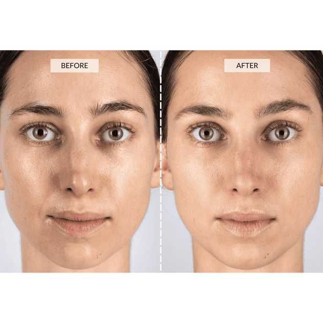 Світлодіодна маска для покращення шкіри CurrentBody Skin Series 2 + подарунок