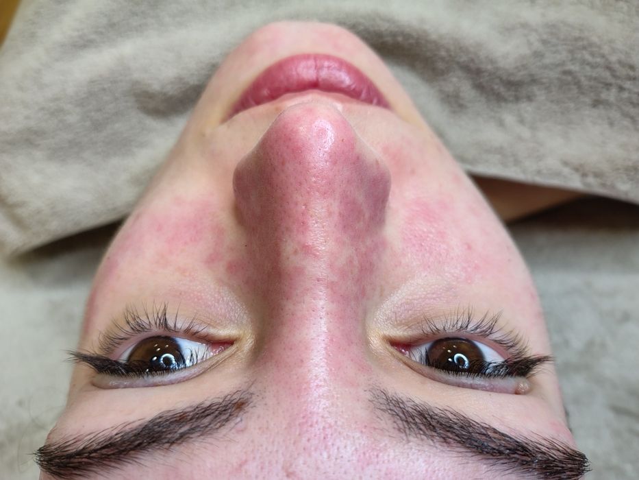 Limpeza de pele profunda