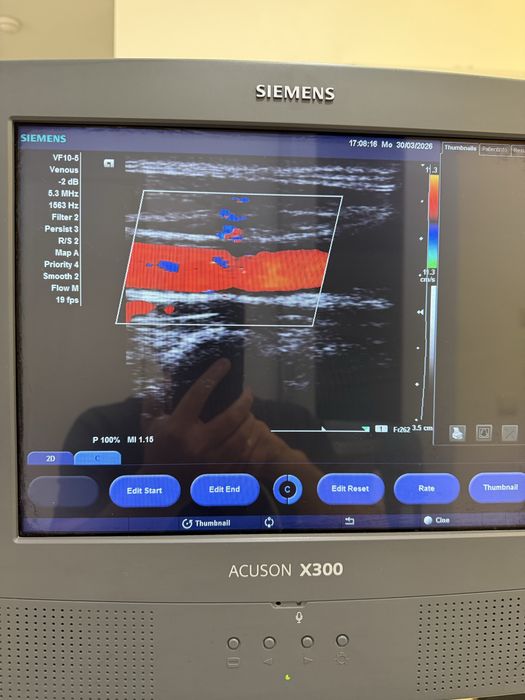 УЗД апарат Simens Acuson X300