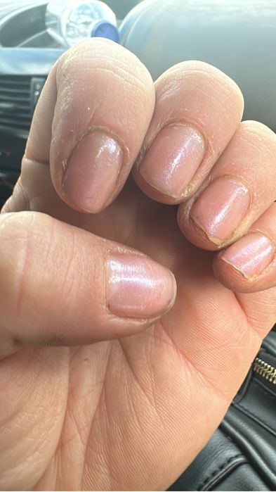 Unhas normais e gel
