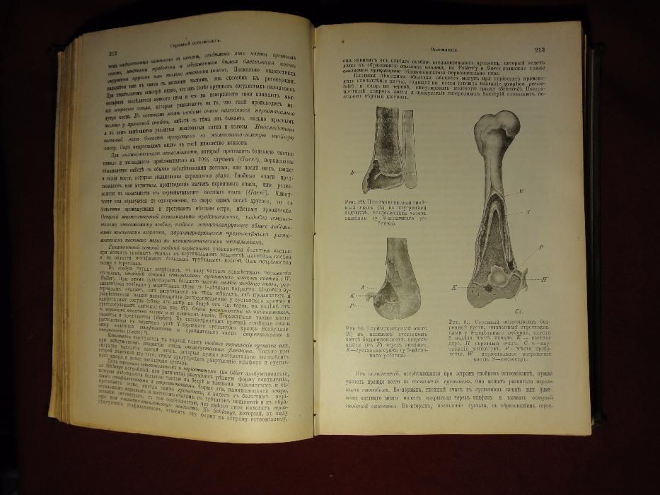 Раритет, редкая книга по Хирургии 1906 г. Кёнигсберг