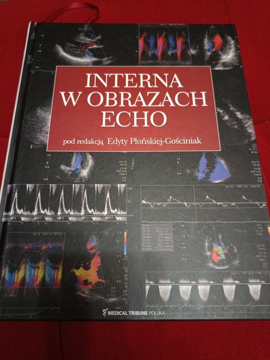 "Interna w obrazach echo"E.Płońska-Gościniak