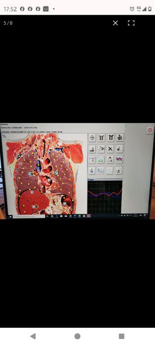 HUNTER 4025 Biorezonans Skaner i Terapia !