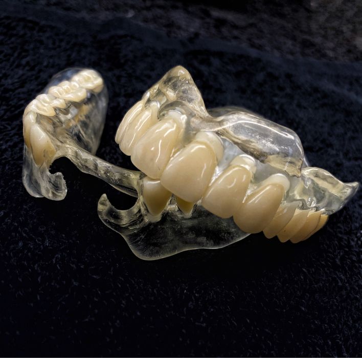 Стоматологія.Знімні протези.Якість та швидкість роботи гарантовано