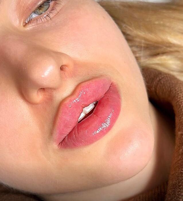 Акция!Индивидуальное обучение:ботулинотерапия,контурная пластика губ