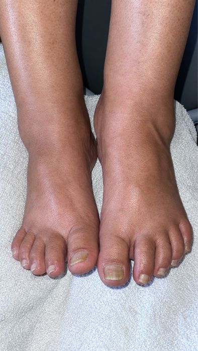 Esteticista certificada  em varios procedimentos