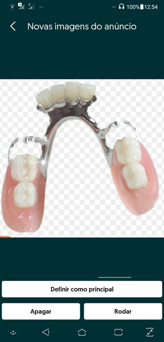 Confecção de próteses  e consertos em geral!!!