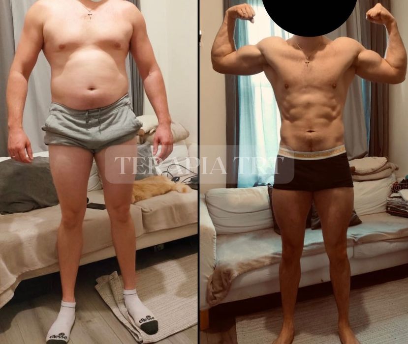 Terapia zastępcza testosteronem