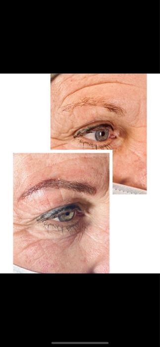 Migroblading fio a fio