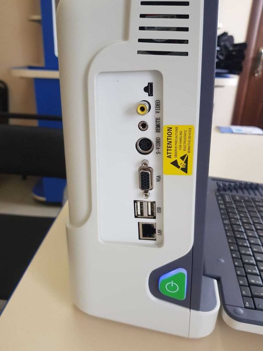 Портативний УЗД апарат MSLCU62