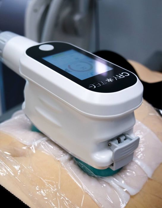 Кріоліполіз cryo 360, від cryotec, апарат криолиполиза