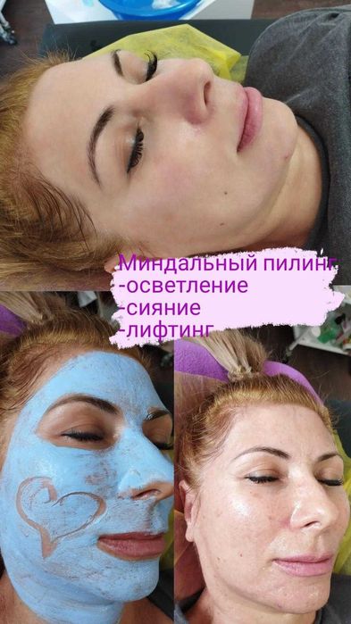 Обучение шугарингу и косметологии с 0!!!