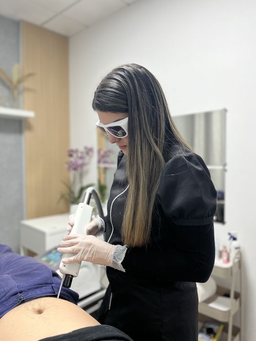 Remoção de tatuagem