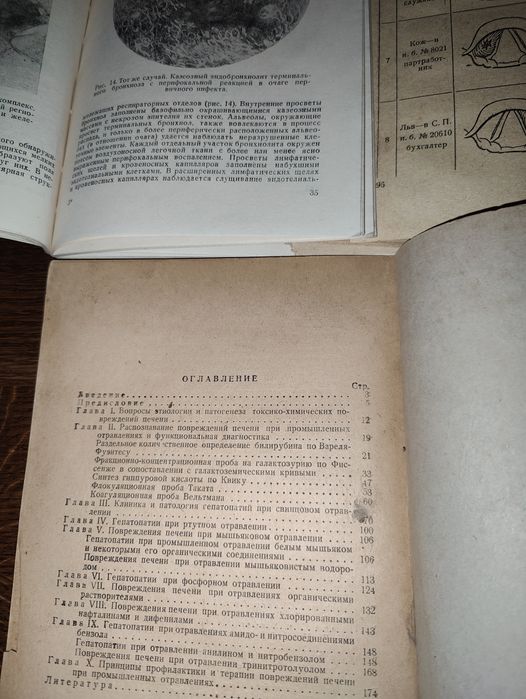 книги 30х, 40х: Туберкулёз бронхиальных желез гортани Гальванокаустика