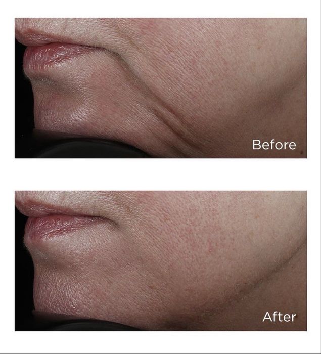 Perricone сировотка для обличчя