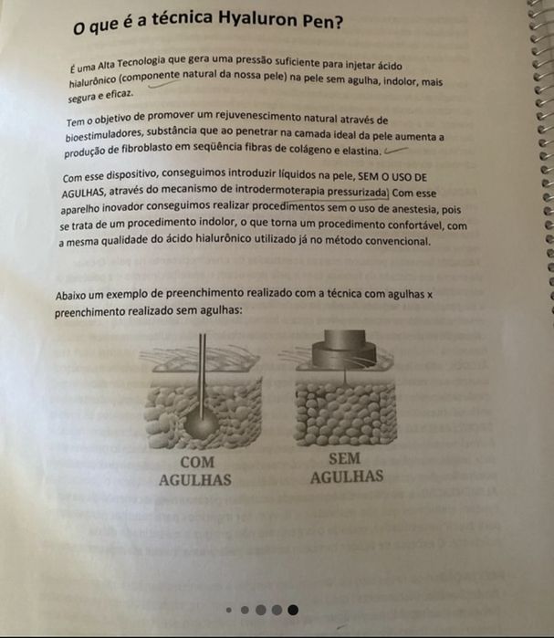 Hyaluron Pen Estetica facial