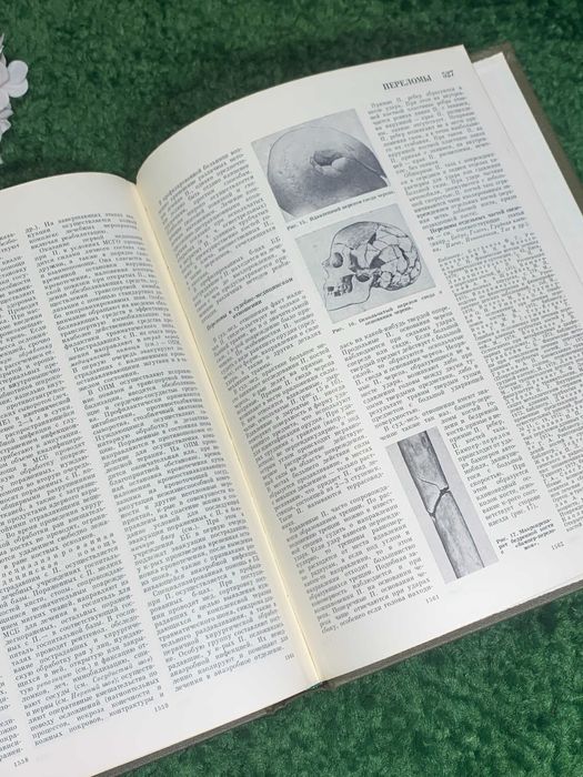 Книга том 18 «Большая медицинская энциклопедия» Остеопатия Переломы 82
