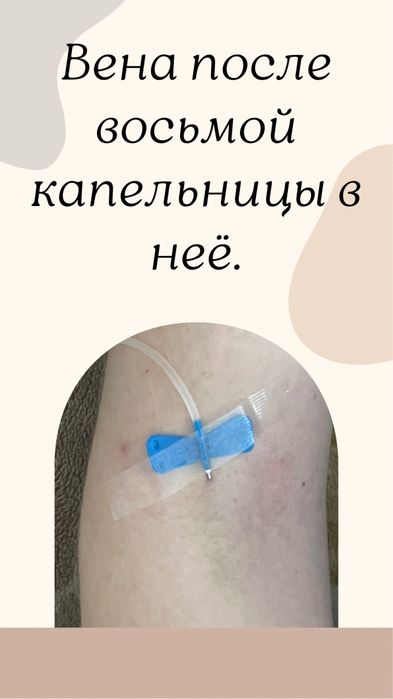 Медсестра на дом, в офис Капельницы, уколы Снятие интоксикации