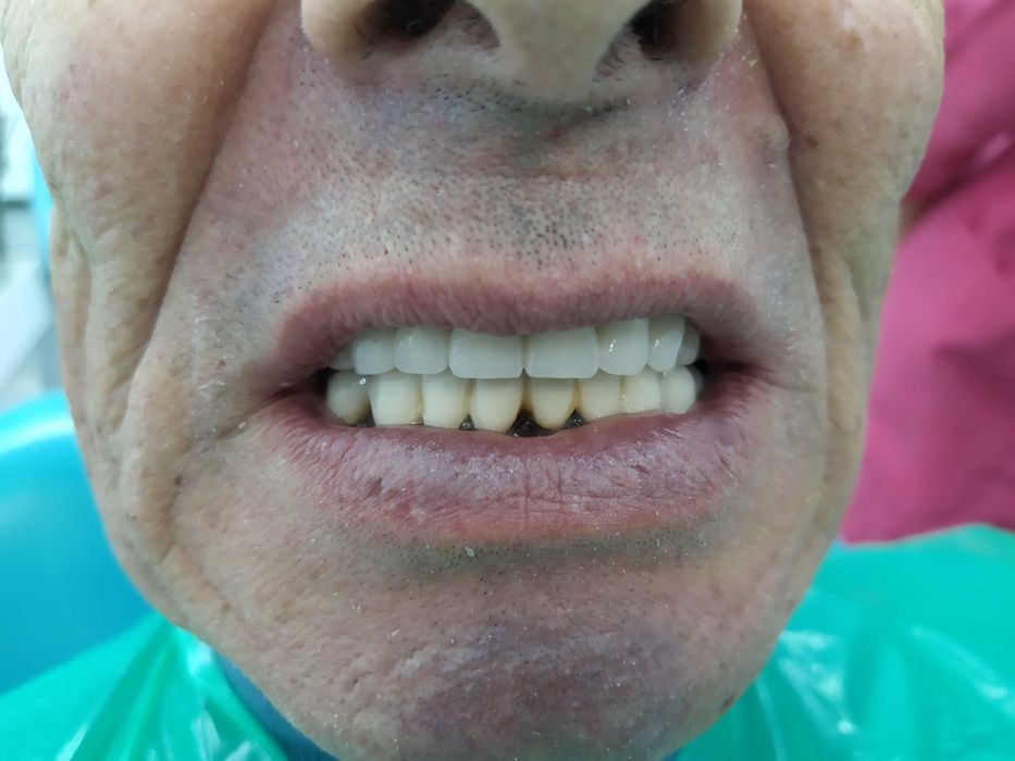 Стоматология. Протезирование .Имплантолгия