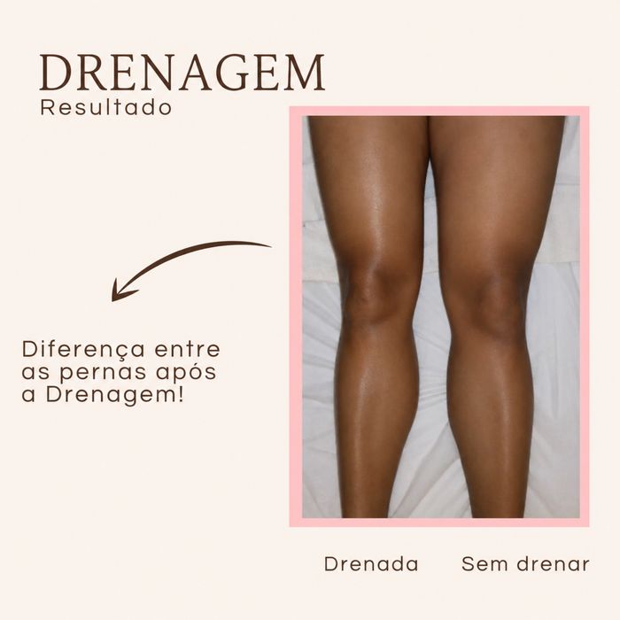 Renata França Lymphatic Drainage Method