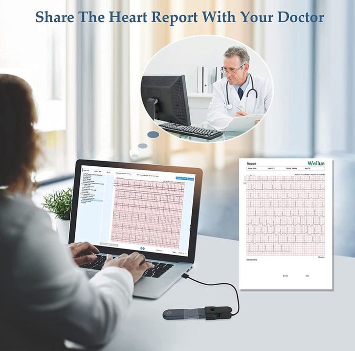 ЕКГ-монітор Wellue, холтерівський реєстратор.