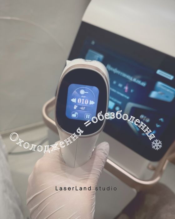 Лазерна епіляція