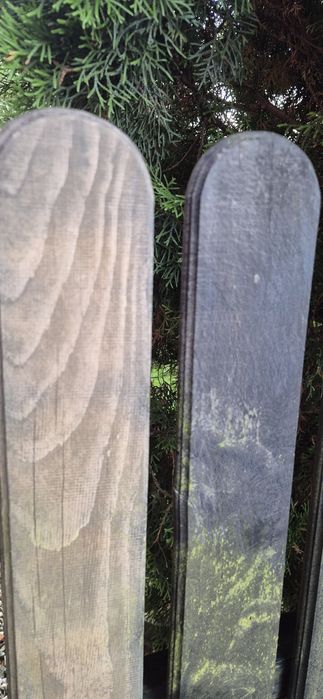 Profesjonalne czyszczenie laserem