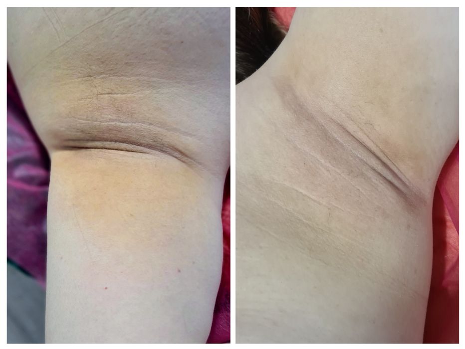 Інтимне відбілювання жіноче  бул. Кольцова