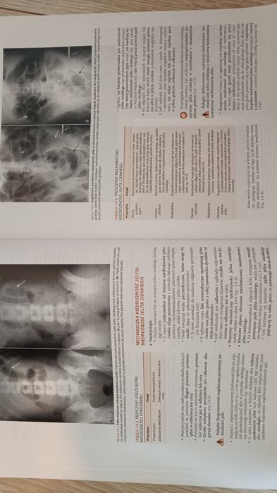 Sprzedam podręcznik radiologia Herring Sąsiadek
