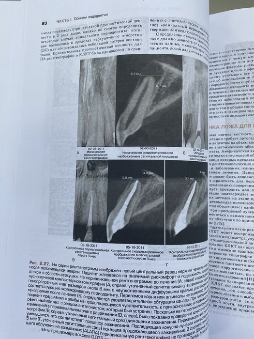 Книга Ендодонтія