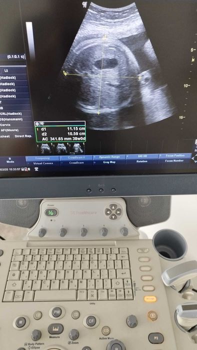 Ecografo GE Logic P6 C/ 2 Sondas