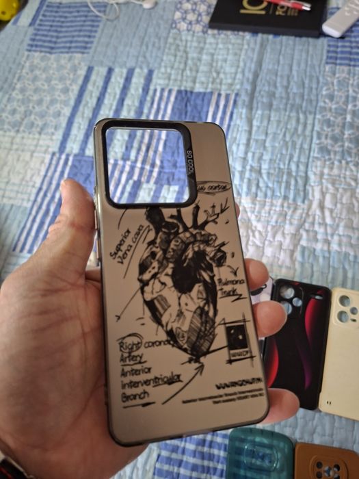 Capas para telemóvel Xiaomi Redmi Note 12 pro,13pro,14pro,Poco X6 pro