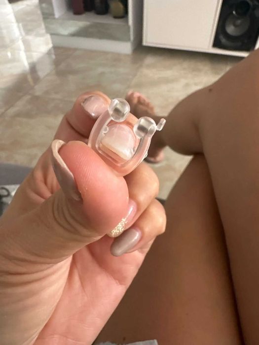 Антихраповой корректор - прибор для предотвращения храпа