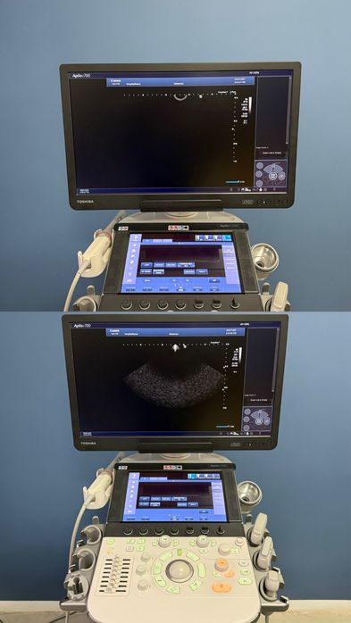 УЗД Toshiba Canon Aplio i700 Ультразвуковий апарат УЗИ сканер