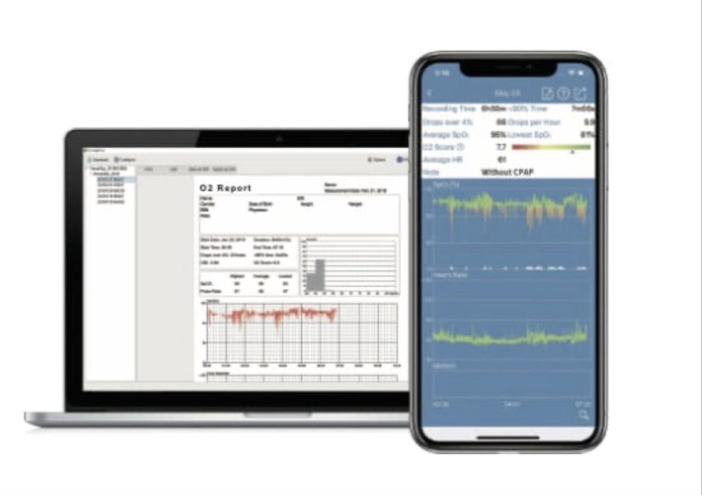 CHECKME O2 Max Monitor Snu z aplikacją iOS / Android