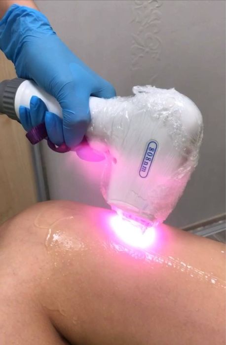 Шугаринг,лазерна епіляція, електроепіляція, массаж,депіляція