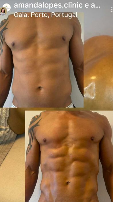 Formação estética