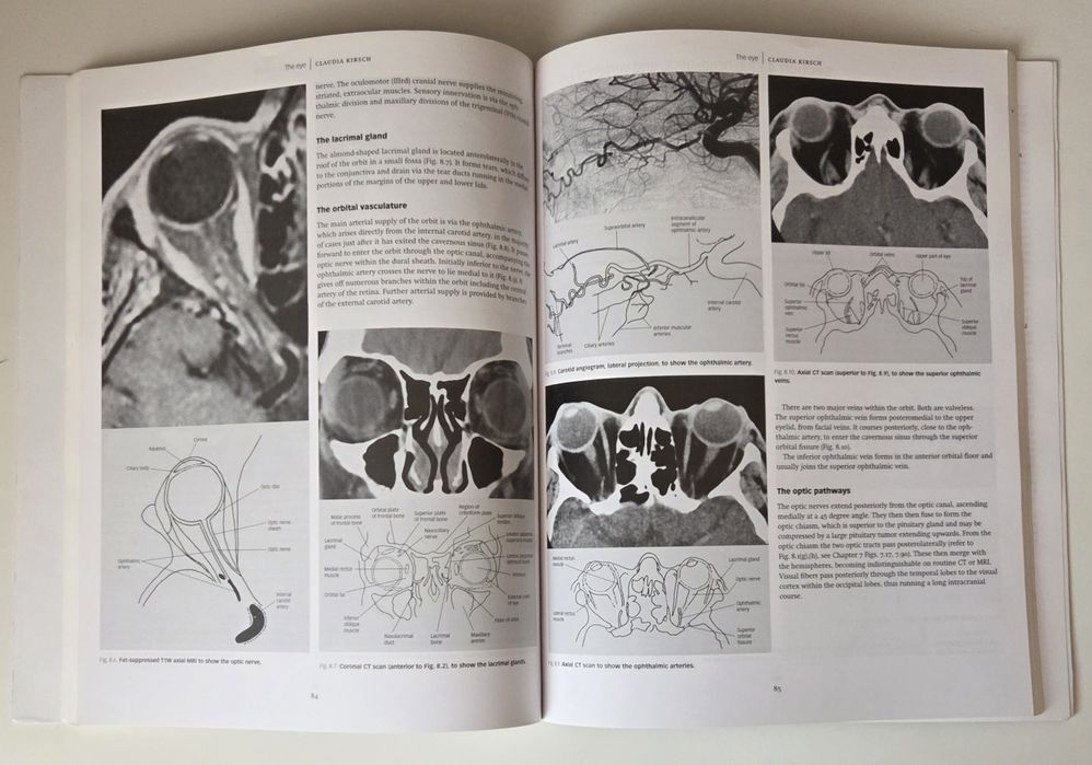 Applied Radiological Anatomy for Medical Students