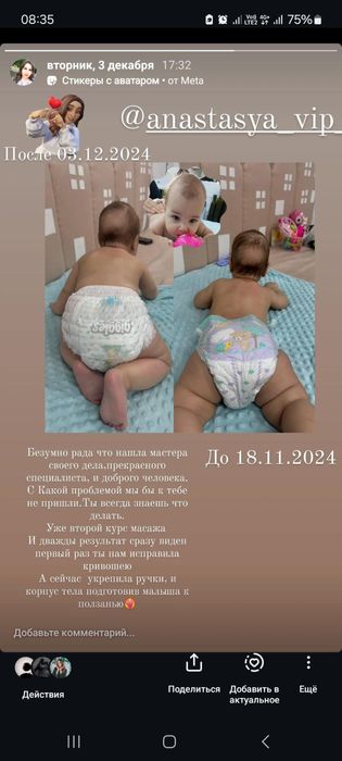 Дитячий масаж. Масаж при сколіозі. Лфк