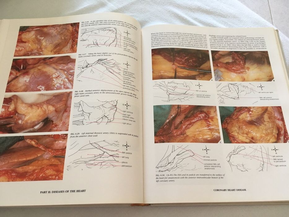 Vendo livro "Atlas of the Heart"